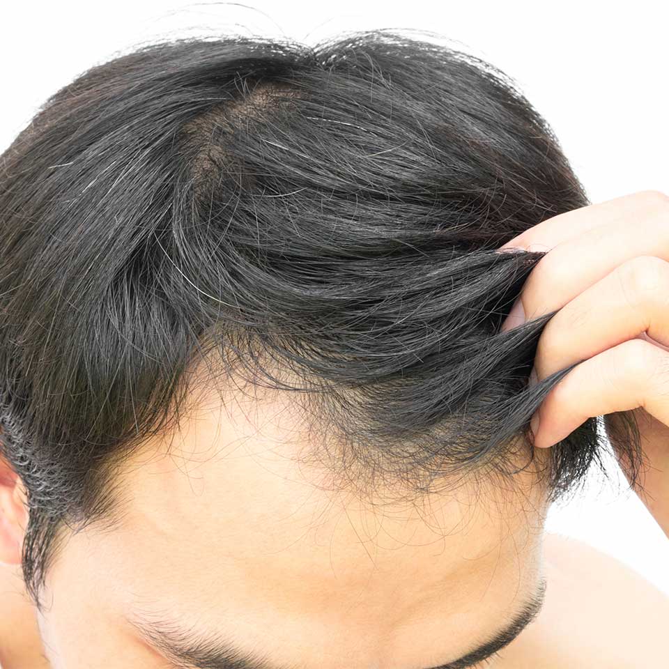 Как остановить седение волос в раннем возрасте у мужчин причины
